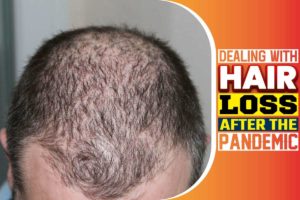Dealing With Hair Loss After the Pandemic