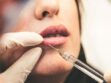 A Guide To Cosmetic Procedures