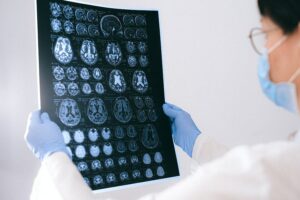 Long-Term Effects Of Traumatic Brain Injury