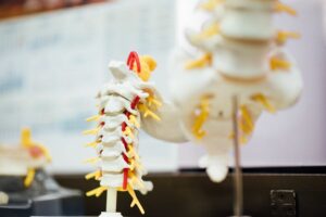 Personal Injury And Spinal Cord Injuries
